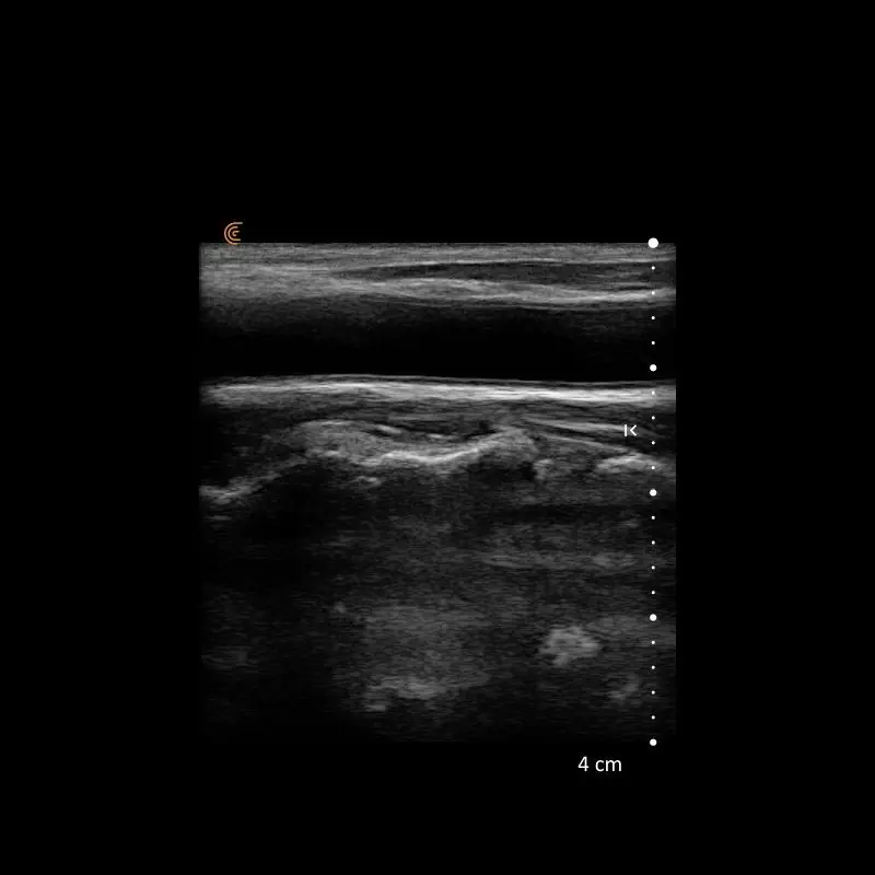 Feature image for the article: Heart Health and Vascular Prevention