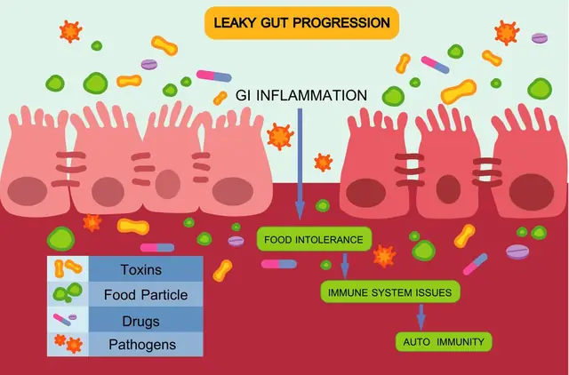 Illustration for the article: The Gut-Brain Connection: How Leaky Gut May Contribute to Chronic Disease