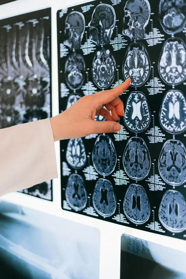 Feature image for the article: The Science Behind Telomeres and Brain Health