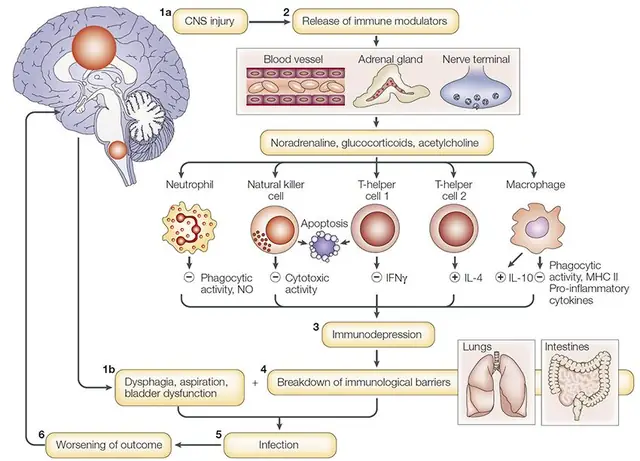 Illustration for the article: Why Does Traumatic Brain Injury Harm Your Gut?