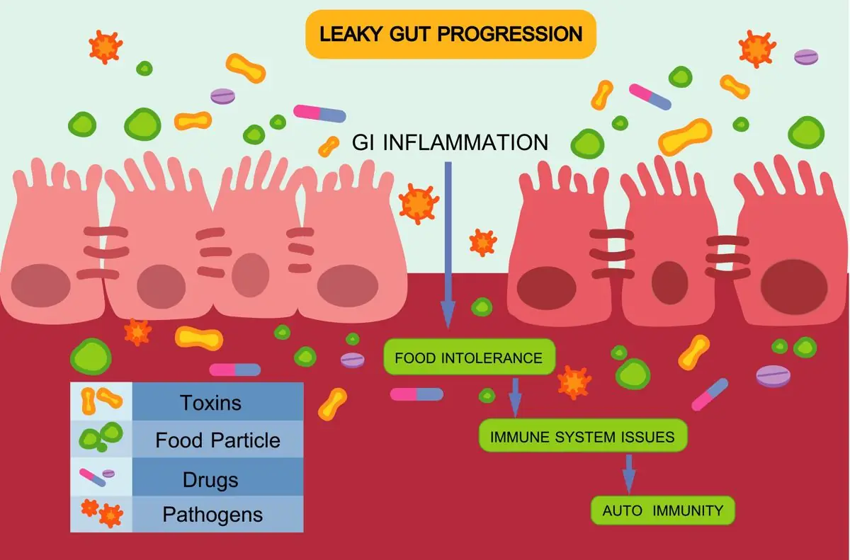 Feature image for the article: The Gut-Brain Connection: How Leaky Gut May Contribute to Chronic Disease